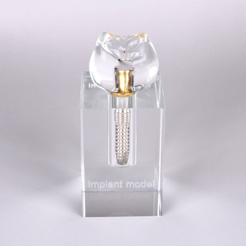 Crystal Implant Model Three Parts Integrated - Image 3