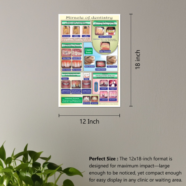 Comprehensive Dental Education Poster Set - Patient Information for Clinics - Image 4