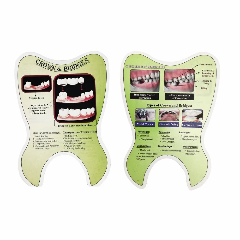 Unique Dents Crown and Bridge Educative Pads, Brouchers, Templates, Patient Education Material, Patient Education booklets, Patient Educational Leaflets/Set of 4 pads